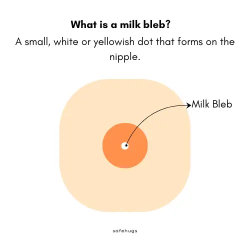 Illustration of milk bleb along with it's definition.