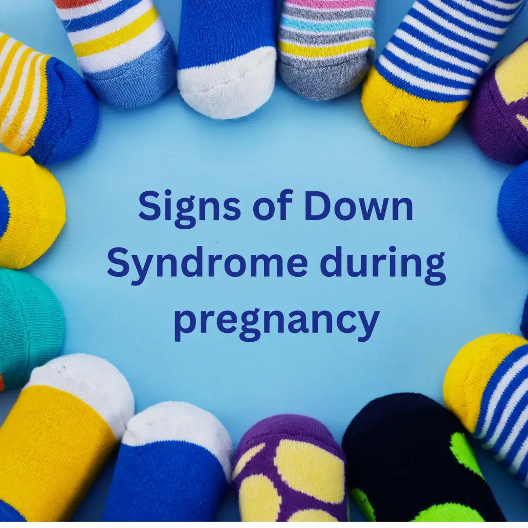 Signs of Down Syndrome