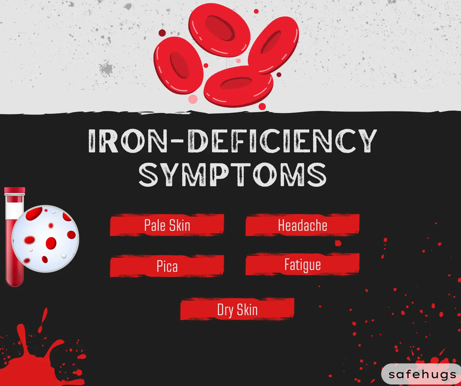 Iron Deficiency in Kids :  Symptoms, Causes & Treatment